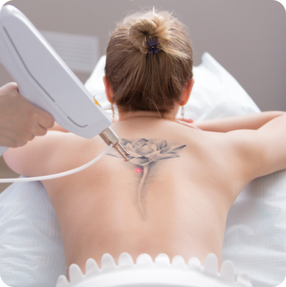 Scar and tattoo removal treatments use advanced techniques like laser therapy to reduce the appearance of scars or eliminate unwanted tattoos, improving skin aesthetics and boosting confidence