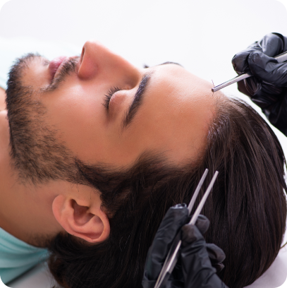 Hair transplant surgery involves moving hair follicles from a donor area to thinning or balding areas, providing natural-looking, permanent hair restoration, improving hair density, and boosting self-confidence.